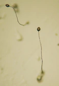 Dictyostelium discoideum - Wikipedia